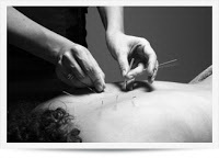 acupuntura doi duvidas